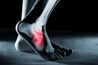 Causes and Risk Factors of Foot Stress Fractures